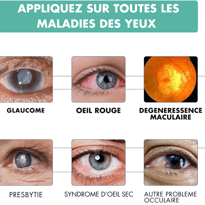 ROULEAU VISION FLOUE - GUERIR TOUTES MALADIES DES YEUX C1 – Image 2